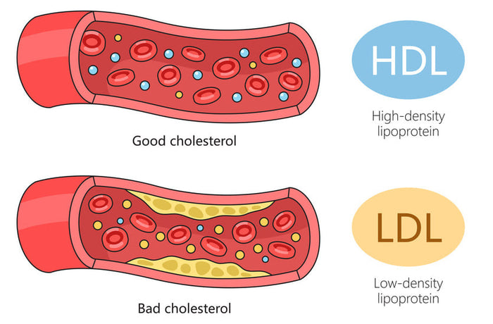 How to Lower Cholesterol Naturally